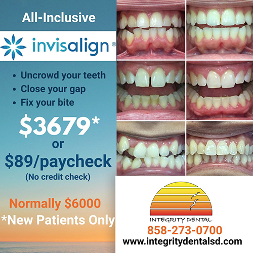 Invisalign Ad Preview